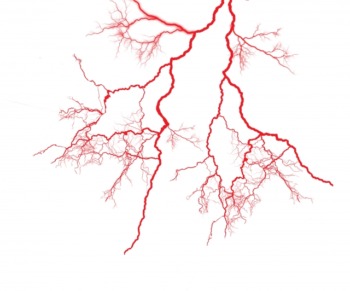 ヒートショック　浴室　予防　浴室暖房換気扇